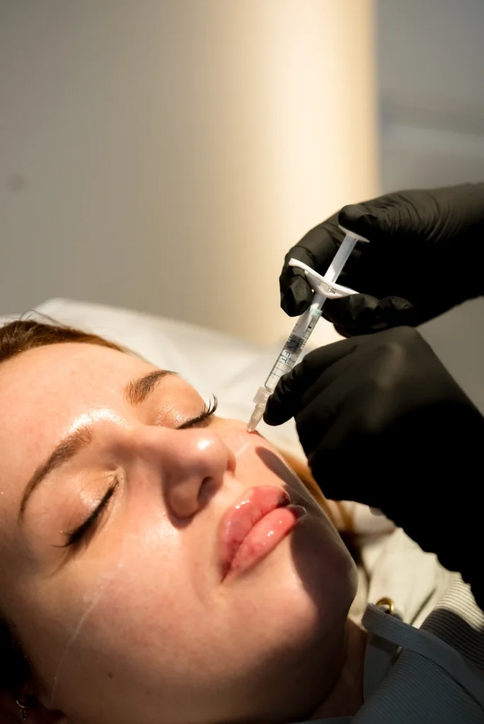 Cheek fillers in stroud, gloucestershire